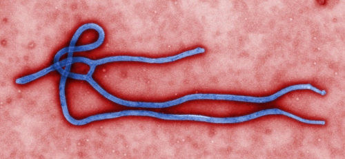 ebola virus - virion