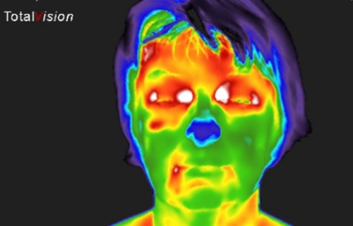 
				Vnetje očesnih živcev			