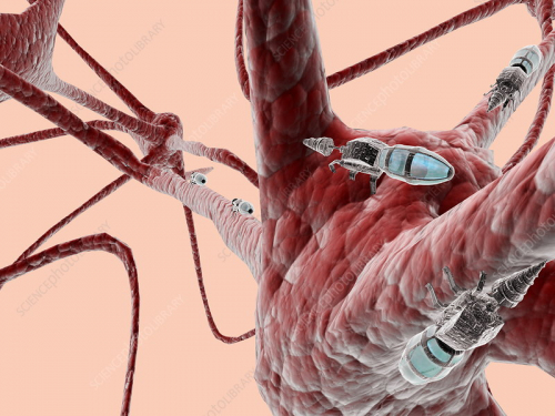 Nanorobots on brain cells - Stock Image - T395/0239 - Science Photo Library